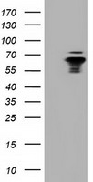 NUMB Antibody - HEK293T cells were transfected with the pCMV6-ENTRY control (Left lane) or pCMV6-ENTRY NUMB (Right lane) cDNA for 48 hrs and lysed. Equivalent amounts of cell lysates (5 ug per lane) were separated by SDS-PAGE and immunoblotted with anti-NUMB.