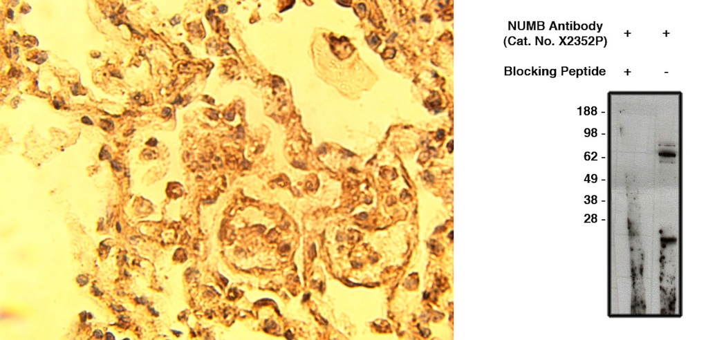 NUMB Antibody - Left: IHC of normal human lung tissue with NUMB antibody at 15 ug/ml. Right: Western blot of anti-NUMB antibody on human brain lysate (14 ug/lane). Antibody was used with (lane 1) and without (lane 2) blocking peptide at 10 ug/ml.