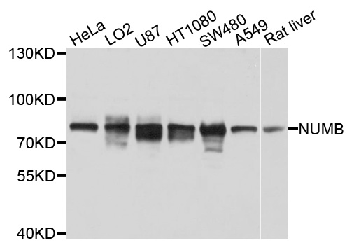 NUMB Antibody - Western blot analysis of extracts of various cells.