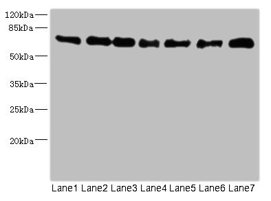 NUMB Antibody - Western blot All Lanes: NUMB antibody at 0.93ug/ml Lane 1: Mouse brain tissue Lane 2: A431 whole cell lysate Lane 3: HepG-2 whole cell lysate Lane 4: Mouse lung tissue Lane 5: Hela whole cell lysate Lane 6: Mouse heart tissue Lane 7: Mouse kidney tissue Secondary Goat polyclonal to rabbit IgG at 1/10000 dilution Predicted band size: 71,66,70,65,56,54,51,49,38 kDa Observed band size: 71 kDa