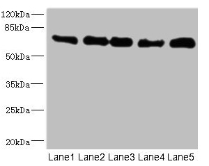 NUMB Antibody - Western blot All lanes: NUMB antibody at 0.93µg/ml Lane 1: Mouse brain tissue Lane 2: A431 whole cell lysate Lane 3: HepG2 whole cell lysate Lane 4: Hela whole cell lysate Lane 5: Mouse kidney tissue Secondary Goat polyclonal to rabbit IgG at 1/10000 dilution Predicted band size: 71, 66, 70, 65, 56, 54, 51, 49, 38 kDa Observed band size: 71 kDa