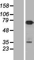 NUMB Protein - Western validation with an anti-DDK antibody * L: Control HEK293 lysate R: Over-expression lysate
