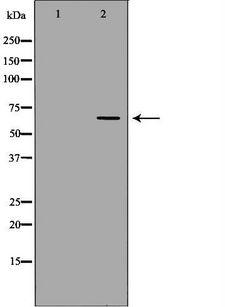 NUMBLIKE / NUMBL Antibody - Western blot analysis of extracts of kidney using NUMBL antibody. The lane on the left is treated with the antigen-specific peptide.