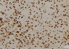 NUMBLIKE / NUMBL Antibody - 1:100 staining mouse brain tissue by IHC-P. The sample was formaldehyde fixed and a heat mediated antigen retrieval step in citrate buffer was performed. The sample was then blocked and incubated with the antibody for 1.5 hours at 22°C. An HRP conjugated goat anti-rabbit antibody was used as the secondary.