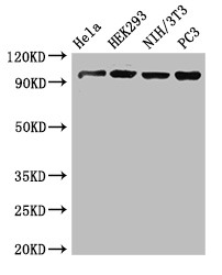 NUP107 Antibody - Positive WB detected in:Hela whole cell lysate,HEK293 whole cell lysate,NIH/3T3 whole cell lysate,PC3 whole cell lysate;All lanes:NUP107 antibody at 3.4?g/ml;Secondary;Goat polyclonal to rabbit IgG at 1/50000 dilution;Predicted band size:107,104,80 KDa;Observed band size: 107 KDa;