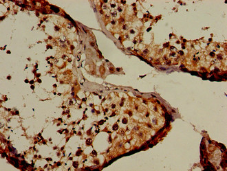 NUP107 Antibody - Immunohistochemistry of paraffin-embedded human testis tissue using NUP107 Antibody at dilution of 1:100