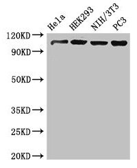 NUP107 Antibody - Western Blot Positive WB detected in: Hela whole cell lysate, HEK293 whole cell lysate, NIH/3T3 whole cell lysate, PC-3 whole cell lysate All lanes: NUP107 antibody at 3.4µg/ml Secondary Goat polyclonal to rabbit IgG at 1/50000 dilution Predicted band size: 107, 104, 80 kDa Observed band size: 107 kDa