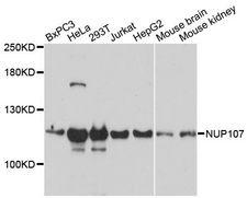 NUP107 Antibody - Western blot analysis of extracts of various cell lines, using NUP107 antibody at 1:3000 dilution. The secondary antibody used was an HRP Goat Anti-Rabbit IgG (H+L) at 1:10000 dilution. Lysates were loaded 25ug per lane and 3% nonfat dry milk in TBST was used for blocking. An ECL Kit was used for detection and the exposure time was 30s.