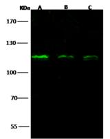 NUP107 Antibody - Anti-NUP107 rabbit polyclonal antibody at 1:500 dilution. Lane A: A549 Whole Cell Lysate. Lane B: Hela Whole Cell Lysate. Lane C: 293T Whole Cell Lysate. Lysates/proteins at 30 ug per lane. Secondary: Goat Anti-Rabbit IgG H&L (Dylight 800) at 1/10000 dilution. Developed using the Odyssey technique. Performed under reducing conditions. Predicted band size: 106 kDa. Observed band size: 115 kDa.