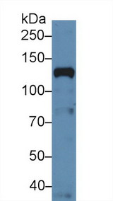 NUP133 Antibody - Western Blot; Sample: Human Hela cell lysate; Primary Ab: 5µg/ml Rabbit Anti-Human NUP133 Antibody Second Ab: 0.2µg/mL HRP-Linked Caprine Anti-Rabbit IgG Polyclonal Antibody