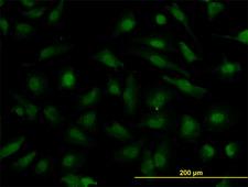 NUP133 Antibody - Immunofluorescence of monoclonal antibody to NUP133 on HeLa cell. [antibody concentration 10 ug/ml]