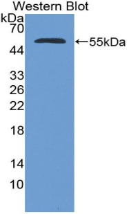 NUP153 Antibody - Western blot of recombinant NUP153.