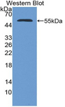 NUP153 Antibody - Western blot of recombinant NUP153.