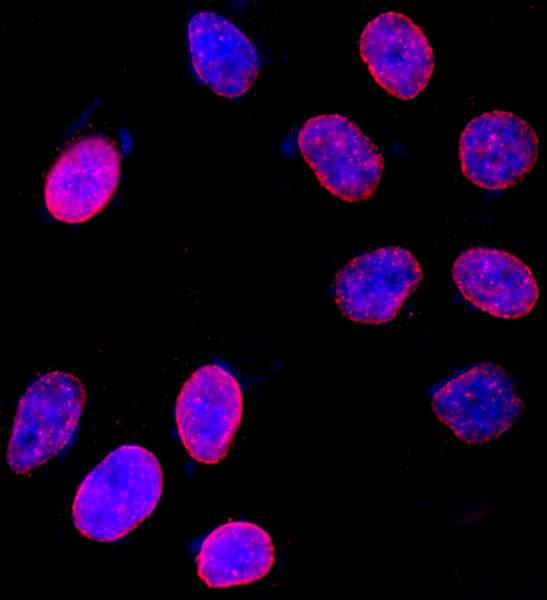 NUP153 Antibody - Detection of Human NUP153 by Immunocytochemistry. Sample: Formaldehyde-fixed asynchronous HeLa cells. Antibody: Affinity purified rabbit anti-NUP153 used at a dilution of 1:200 (1 ug/ml). Detection: Red-fluorescent goat anti-rabbit IgG highly cross-adsorbed Antibody used at a dilution of 1:100.