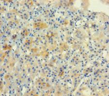 NUP153 Antibody - Immunohistochemistry of paraffin-embedded human adrenal gland tissue using NUP153 Antibody at dilution of 1:100