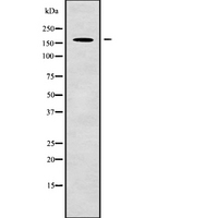 NUP153 Antibody - Western blot analysis NUP153 using COLO205 whole cells lysates
