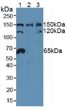 NUP155 Antibody