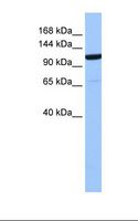NUP155 Antibody - 721_B cell lysate. Antibody concentration: 1.0 ug/ml. Gel concentration: 6%-18%.  This image was taken for the unconjugated form of this product. Other forms have not been tested.