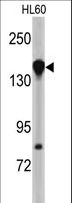 NUP155 Antibody - Western blot of NUP155 antibody in HL60 cell line lysates (35 ug/lane). NUP155 (arrow) was detected using the purified antibody.