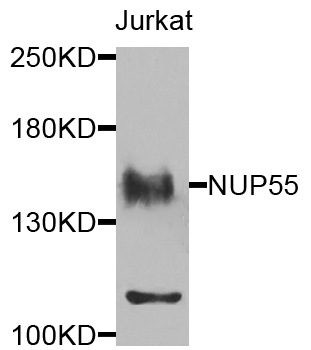 NUP155 Antibody - Western blot analysis of extracts of Jurkat cells.