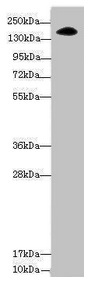 NUP155 Antibody - Western blot All lanes: NUP155 antibody at 3.47µg/ml + Hela whole cell lysate Secondary Goat polyclonal to rabbit IgG at 1/10000 dilution Predicted band size: 156, 150 kDa Observed band size: 156 kDa