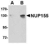 NUP155 Antibody - Western blot of NUP155 in P815 cell lysate with NUP155 antibody at (A) 0.5 and (B) 1 ug/ml.