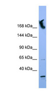 NUP155 Antibody - NUP155 antibody Western blot of HT1080 cell lysate. This image was taken for the unconjugated form of this product. Other forms have not been tested.