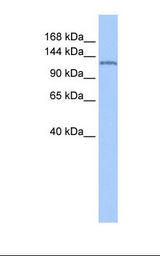 NUP155 Antibody - Jurkat cell lysate. Antibody concentration: 1.0 ug/ml. Gel concentration: 6-18%.  This image was taken for the unconjugated form of this product. Other forms have not been tested.