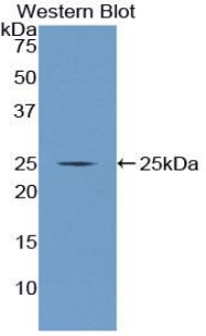 NUP160 Antibody - Western blot of recombinant NUP160.  This image was taken for the unconjugated form of this product. Other forms have not been tested.