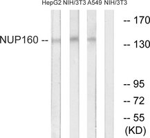 NUP160 Antibody - Western blot analysis of lysates from NIH/3T3, A549, and HepG2 cells, using NUP160 Antibody. The lane on the right is blocked with the synthesized peptide.