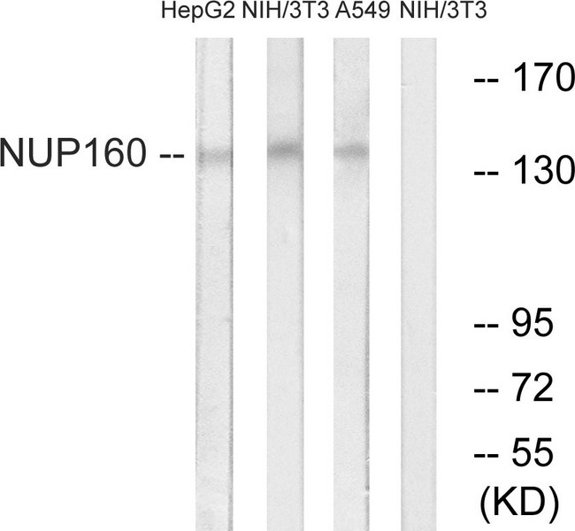 NUP160 Antibody - Western blot analysis of lysates from NIH/3T3, A549, and HepG2 cells, using NUP160 Antibody. The lane on the right is blocked with the synthesized peptide.