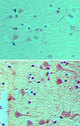 NUP160 Antibody - IHC of NUP160 in formalin-fixed, paraffin-embedded human brain tissue using preimmune sera (top) and Polyclonal Antibody to NUP160 (bottom) at 1:100.