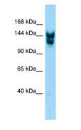 NUP160 Antibody - NUP160 antibody Western Blot of Mouse Small Intestine.  This image was taken for the unconjugated form of this product. Other forms have not been tested.