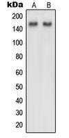 NUP160 Antibody - Western blot analysis of NUP160 expression in HeLa (A); NIH3T3 (B) whole cell lysates.