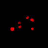 NUP160 Antibody - Immunofluorescent analysis of NUP160 staining in NIH3T3 cells. Formalin-fixed cells were permeabilized with 0.1% Triton X-100 in TBS for 5-10 minutes and blocked with 3% BSA-PBS for 30 minutes at room temperature. Cells were probed with the primary antibody in 3% BSA-PBS and incubated overnight at 4 C in a humidified chamber. Cells were washed with PBST and incubated with a DyLight 594-conjugated secondary antibody (red) in PBS at room temperature in the dark. DAPI was used to stain the cell nuclei (blue).