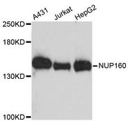 NUP160 Antibody - Western blot analysis of extracts of various cell lines, using NUP160 antibody at 1:3000 dilution. The secondary antibody used was an HRP Goat Anti-Rabbit IgG (H+L) at 1:10000 dilution. Lysates were loaded 25ug per lane and 3% nonfat dry milk in TBST was used for blocking. An ECL Kit was used for detection and the exposure time was 180s.