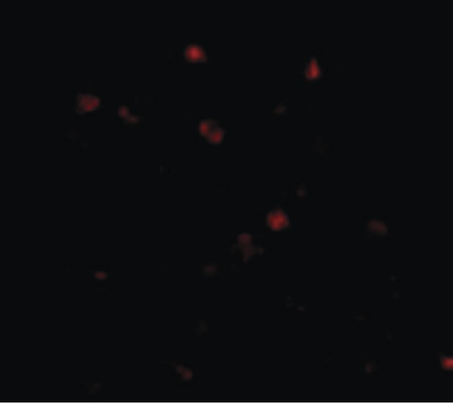 NUP160 Antibody - Immunofluorescence of NUP160 in Human Brain cells with NUP160 antibody at 20 ug/ml.
