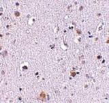 NUP160 Antibody - Immunohistochemistry of NUP160 in human brain tissue with NUP160 antibody at 2.5 ug/ml.