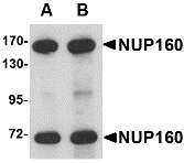 NUP160 Antibody - Western blot of NUP160 in rat brain tissue lysate with NUP160 antibody at (A) 0.5 and (B) 1 ug/ml.