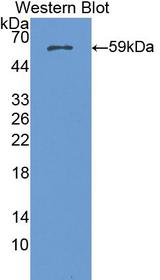 NUP188 Antibody - Western Blot; Sample: Recombinant protein.