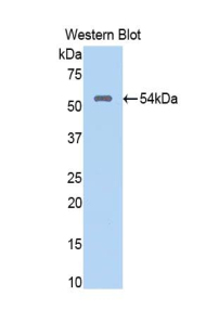NUP188 Antibody - Western blot of recombinant NUP188.  This image was taken for the unconjugated form of this product. Other forms have not been tested.