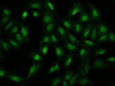 NUP188 Antibody - Immunofluorescence staining of NUP188 in U2OS cells. Cells were fixed with 4% PFA, permeabilzed with 0.1% Triton X-100 in PBS, blocked with 10% serum, and incubated with rabbit anti-Human NUP188 polyclonal antibody (dilution ratio 1:200) at 4°C overnight. Then cells were stained with the Alexa Fluor 488-conjugated Goat Anti-rabbit IgG secondary antibody (green). Positive staining was localized to Nucleus.