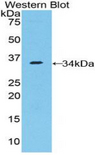NUP205 Antibody - Western blot of recombinant NUP205.  This image was taken for the unconjugated form of this product. Other forms have not been tested.