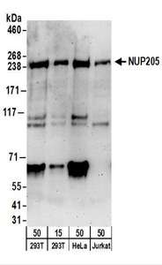 NUP205 Antibody - Detection of Human NUP205 by Western Blot. Samples: Whole cell lysate from 293T (15 and 50 ug), HeLa (50 ug), and Jurkat (50 ug) cells. Antibodies: Affinity purified rabbit anti-NUP205 antibody used for WB at 0.1 ug/ml. Detection: Chemiluminescence with an exposure time of 3 minutes.