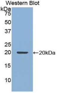 NUP210 / gp210 Antibody - Western blot of recombinant NUP210 / gp210.