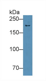 NUP210 / gp210 Antibody - Western Blot; Sample: Mouse Spleen lysate; Primary Ab: 2µg/mL Rabbit Anti-Mouse NUP210 Antibody Second Ab: 0.2µg/mL HRP-Linked Caprine Anti-Rabbit IgG Polyclonal Antibody