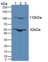 NUP210 / gp210 Antibody - Western Blot; Sample: Lane1: Human Lung Tissue; Lane2: Human MCF-7 Cells; Lane3: Mouse Thymus Tissue.