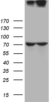 NUP210 / gp210 Antibody - HEK293T cells were transfected with the pCMV6-ENTRY control. (Left lane) or pCMV6-ENTRY NUP210. (Right lane) cDNA for 48 hrs and lysed