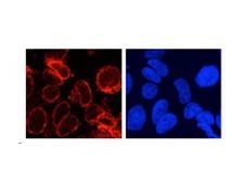 NUP210 / gp210 Antibody - Immunocytochemistry/ Immunofluorescence - GP210 antibody on formaldehyde fixed HeLa cells