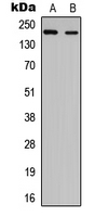 NUP210L Antibody - Western blot analysis of NUP210L expression in HEK293T (A); PC12 (B) whole cell lysates.